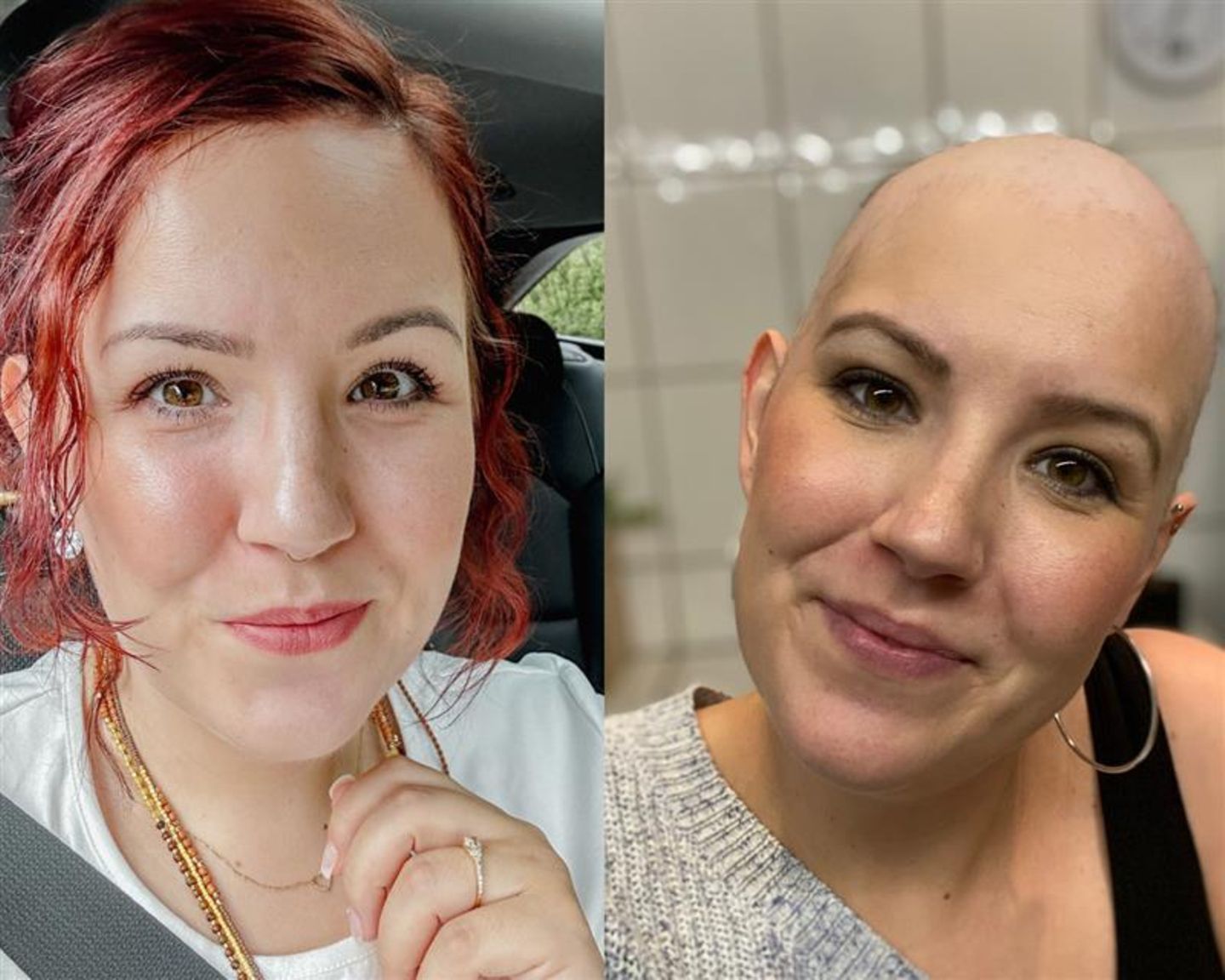 Christin Schilling vor und nach der Therapie