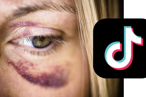 Kollage mit einer Nahaufnahme eine Frau mit Feilchen und dem TikTok-Logo
