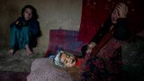 World Press Photo: Krankes Kind Afghanistan