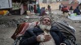 World Press Photo: Behandelter Mann in Torkham