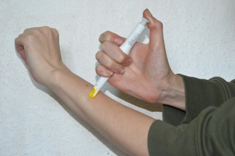 Der Zeckengreifer von Ticksafe aus DHDL auf der Haut