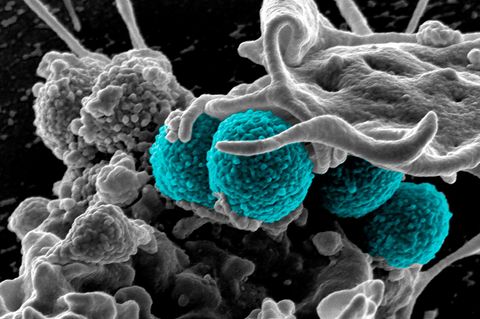 Antibiotika-Resistenz: Die Abbildung zeigt einen Methicillin-resistenten Staphylococcus aureus-Stamm