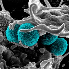 Antibiotika-Resistenz: Die Abbildung zeigt einen Methicillin-resistenten Staphylococcus aureus-Stamm