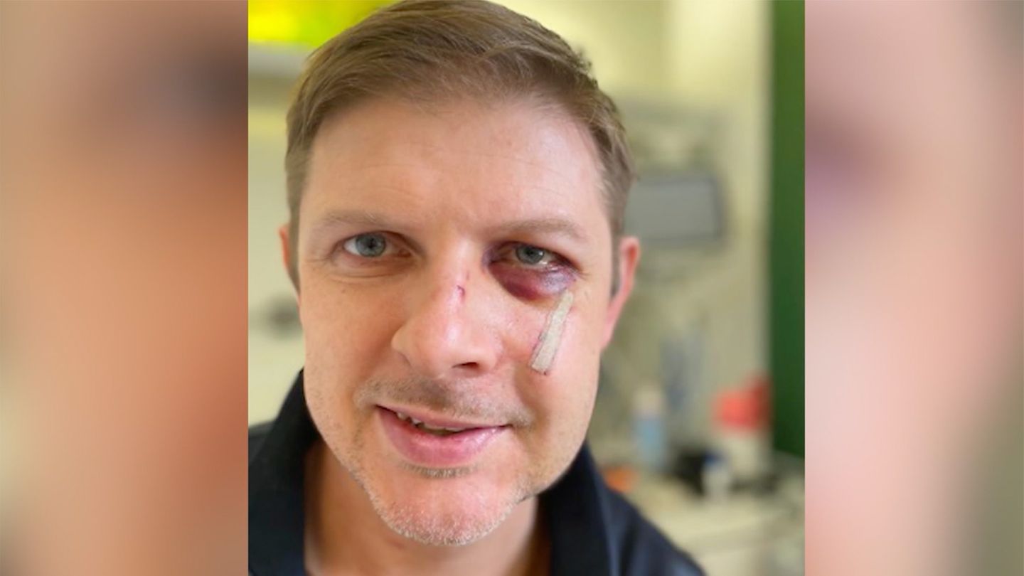 Attacke auf Matthias Ecke: Verletzter Politiker meldet sich mit Selfie aus Klinik – Parteikollegen fordern: 