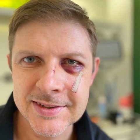 SPD-Politiker Ecke meldet sich nach Attacke aus Krankenhaus
