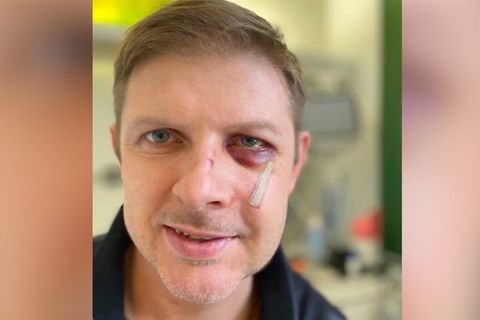 SPD-Politiker Ecke meldet sich nach Attacke aus Krankenhaus