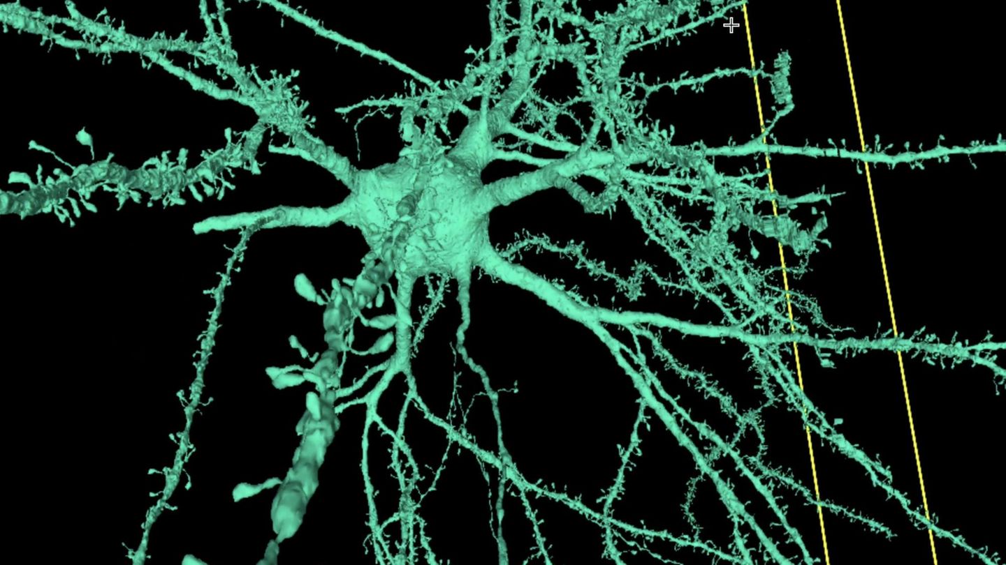 Detailliertes 3D-Modell: Wissenschaftlicher Durchbruch: So sieht das menschliche Gehirn tatsächlich aus