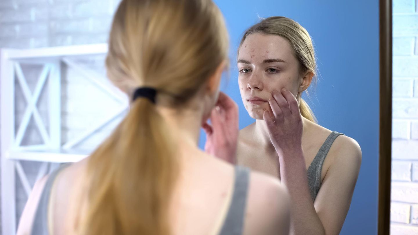 Pubertät: Ein junges Mädchen betrachtet ihre Haut im Spiegel