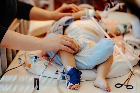 Eines kleines Kind wird intensivmedizinisch behandelt