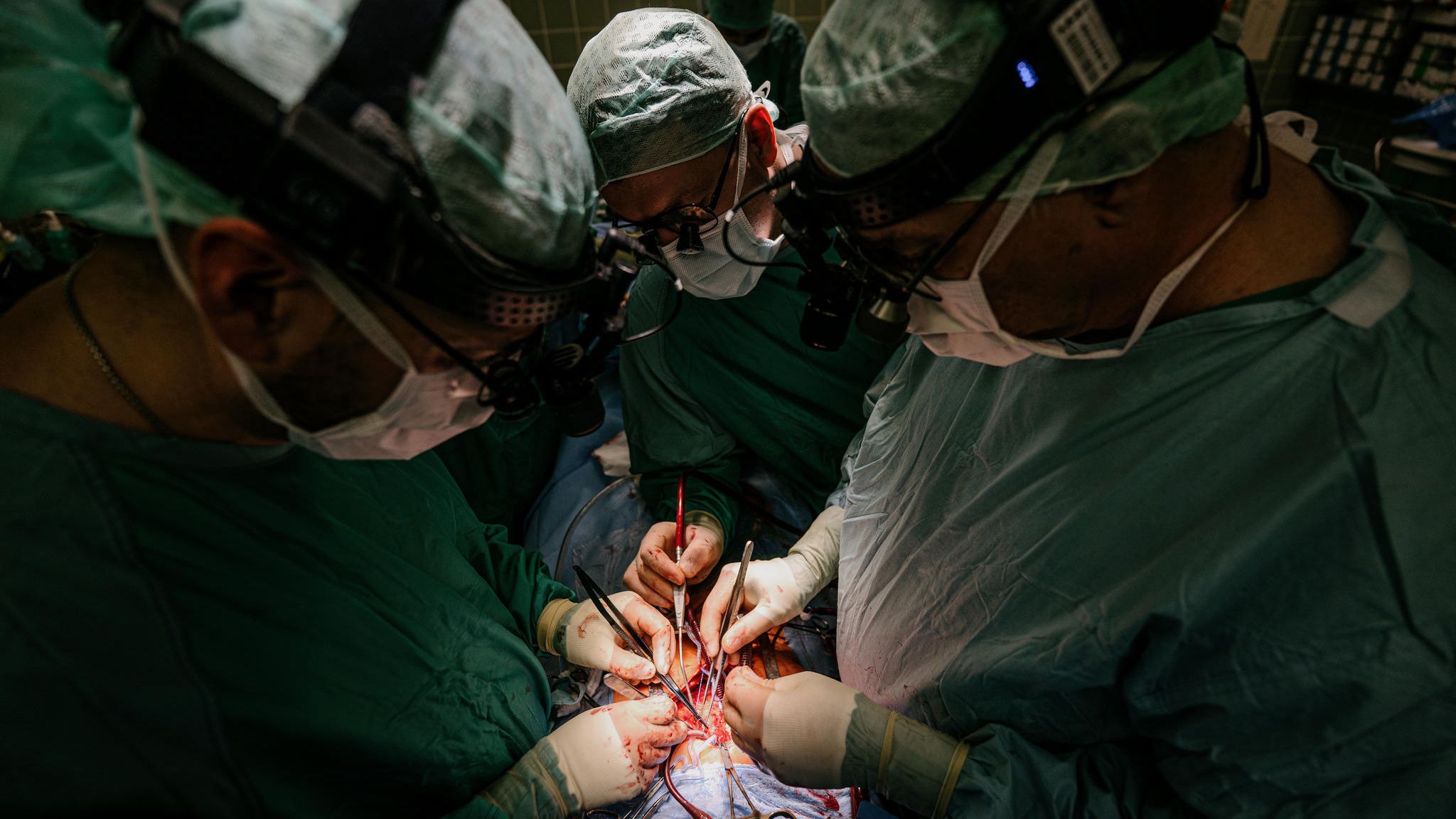 Kinderherzchirurgen bei einer Operation an der MHH