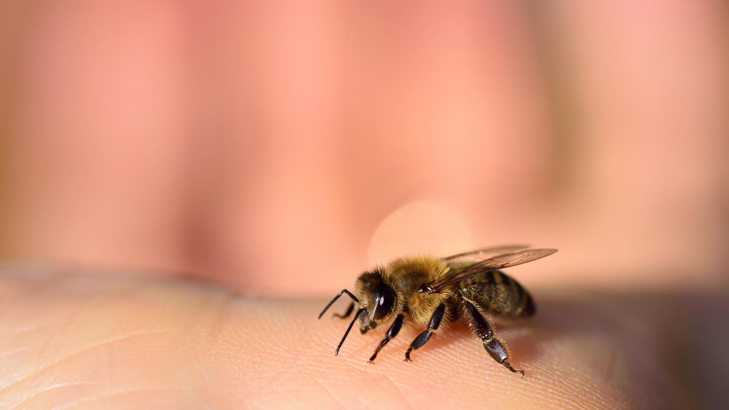 Bee sting: What helps when a bee has stabbed