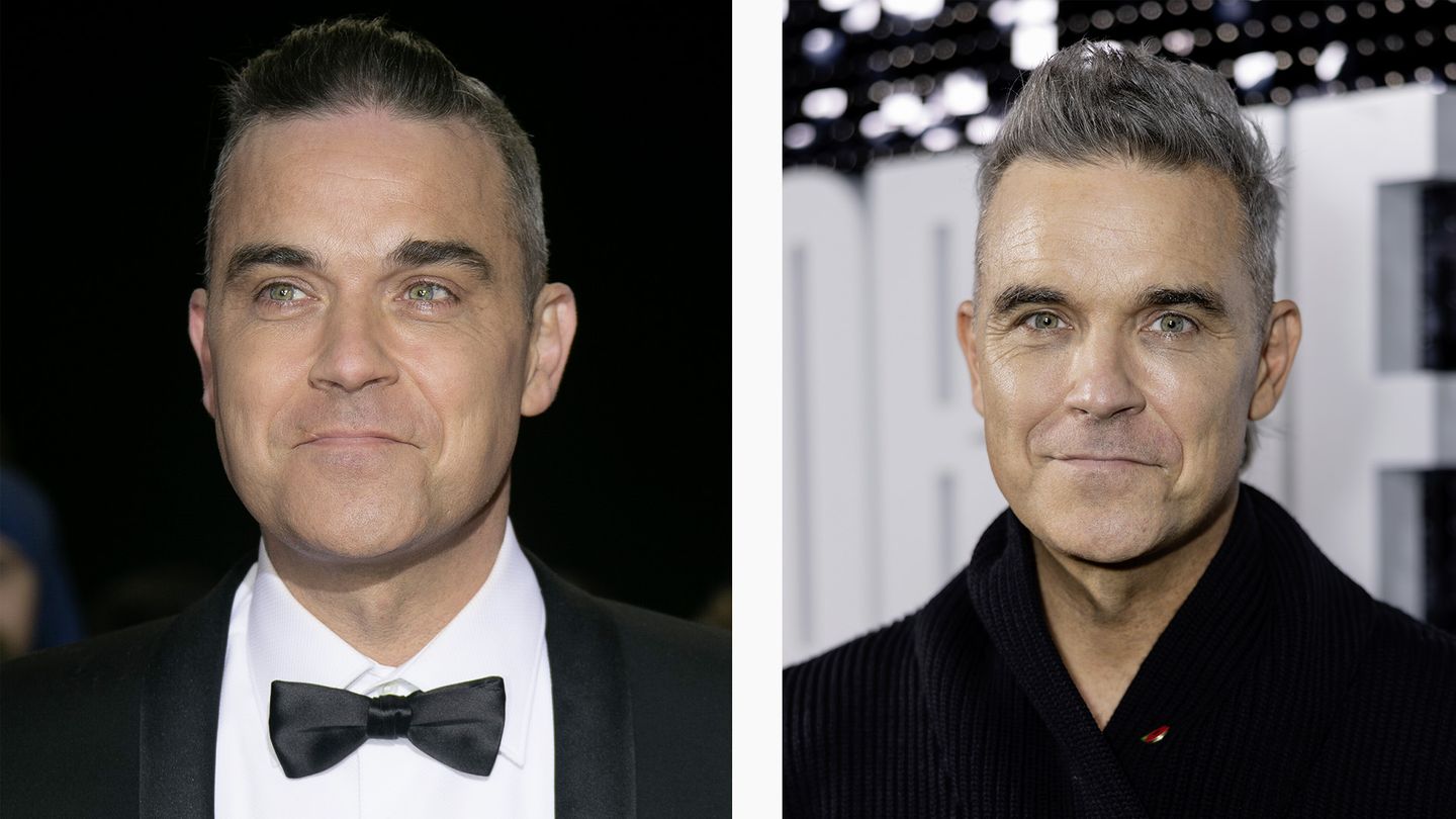 Ozempic Robbie Williams Bildkombination Robbie Williams vor Ozempic und danach