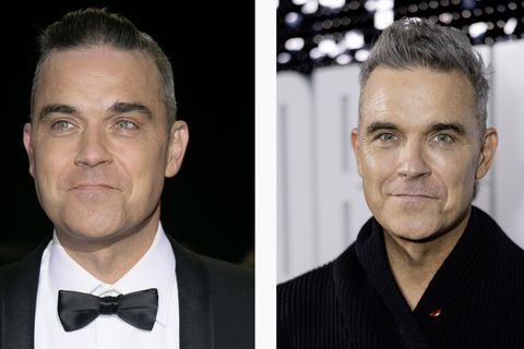 Bildkombination Robbie Williams vor Ozempic und danach