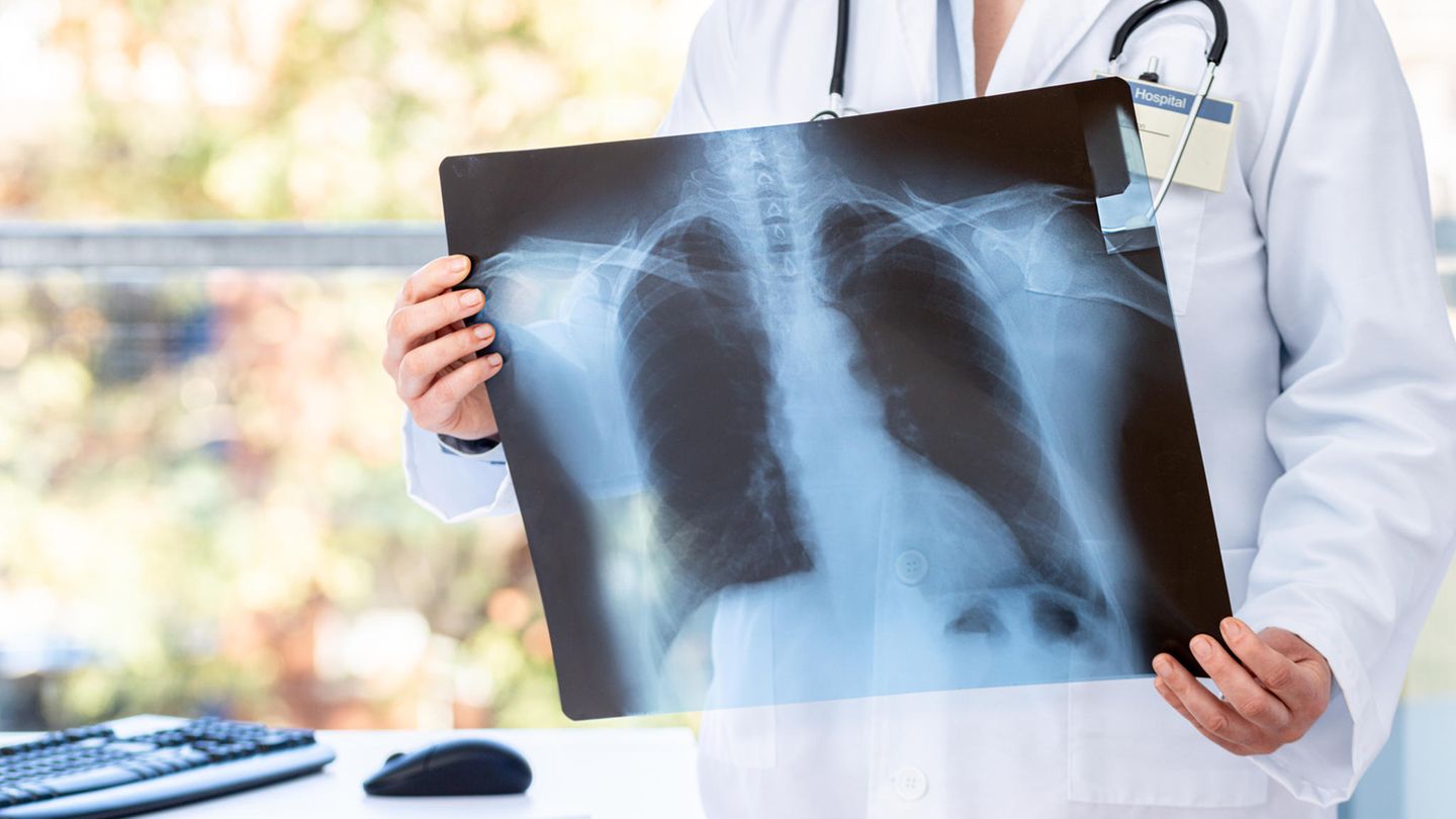 Hier finden Sie ausgezeichnete Rehakliniken im Bereich Long Covid. 