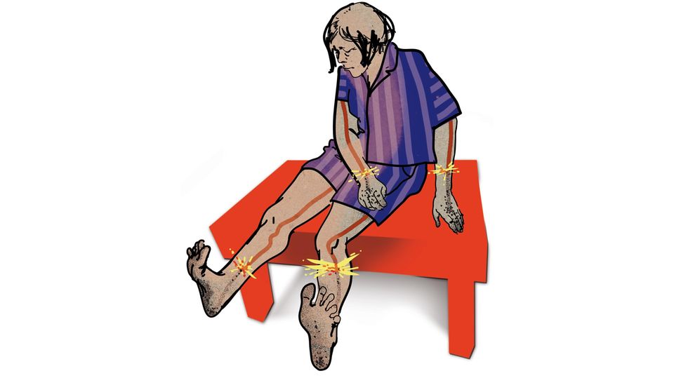 Schmerzen In Armen Und Beinen Psychosomatisch www.stern.de