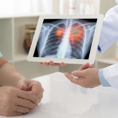 Hier finden Sie ausgezeichnete Kliniken im Bereich Lungenkrebs. 
