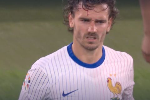 Frankreichs Antoine Griezmann lief nach dem Zusammenprall mit einer Werbebande Blut über die Stirn