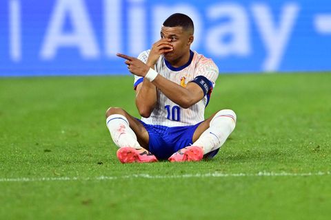 Aua: Kylian Mbappé sitzt mit blutender Nase  auf dem Rasen der Düsseldorfer Arena