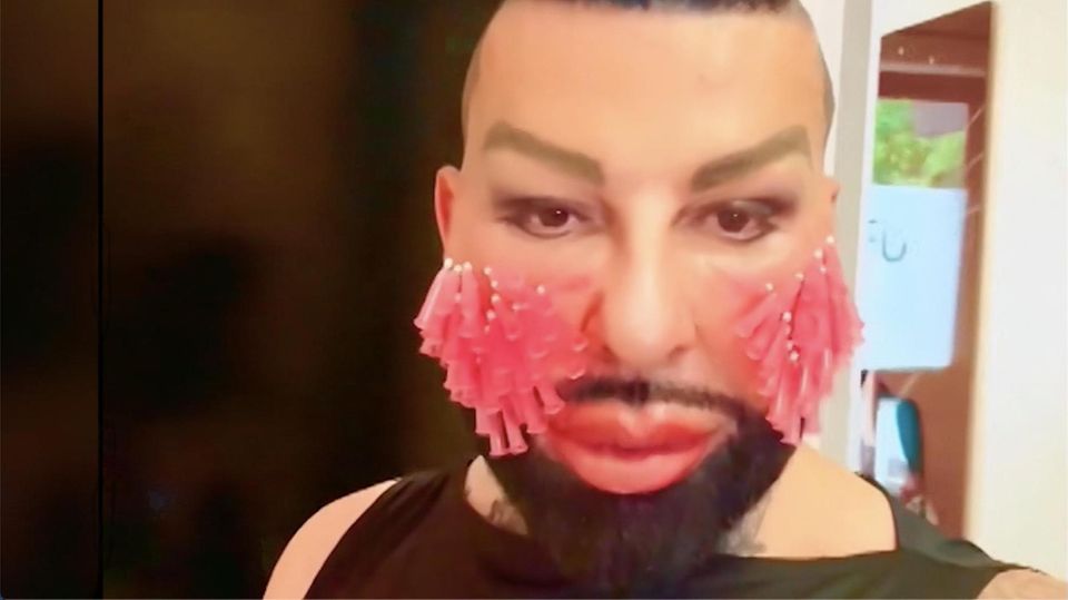 "Kein Gesichtsschmuck": Bizarre Beauty-Behandlung: Harald Glööckler zeigt sich mit 50 Spritzen im Gesicht