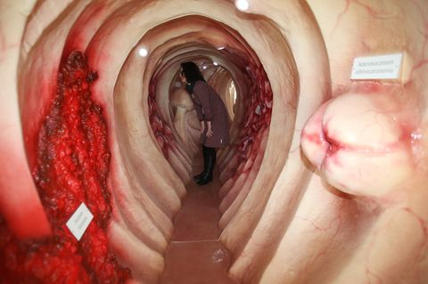Darmkrebs-Vorsorge: Chemischer Nachweis von Blut im Stuhl  Anschaulicher geht es nicht: Das Bild zeigt das begehbare Modell des Darms samt der möglichen Krankheiten. Bei Frauen ist Darmkrebs die zweithäufigste Krebsart, bei Männern die dritthäufigste. Nicht rechtzeitig erkannt endet die Erkrankung in der Regel tödlich. Dabei erkranken Männer früher und häufiger an der der bösartigen Veränderung der Schleimhaut, meist im Dickdarm und im Enddarm. Ihr Risiko steigt zudem mit dem Alter. Bereits ab 50 wird die Vorsorge daher von den Kassen getragen. Bei Frauen hingegen tritt Darmkrebs später auf und steigt Studien zufolge noch einmal ab Mitte Siebzig an.   Ab 50 sollte man alles fünf Jahre eine Darmspiegelung einplanen. Die Methode ist sehr treffsicher und kann verhindern, dass Darmkrebs entsteht, da schon Vorstufen entfernt werden können. Sie liefert nur selten blinden Alarm, ihre Qualität wird in Deutschland überwacht, der Arzt muss die Untersuchung mindestens 200 Mal im Jahr durchführen.   Neben der aufwändigen Darmspiegelung lässt sich mögliches Tumorgeschehen auch über eine Stuhlprobe ermitteln. Beim Arzt bekommt man drei Testkärtchen oder Röhrchen für Stuhlproben. Wird im Labor der Blutfarbstoff Häm im Stuhl nachgewiesen, kann das auf einen Darmtumor hinweisen.  Allerdings kam In Studien heraus, dass der Test rund die Hälfte der Tumoren nicht erkennt. Obendrein schlägt er sehr oft Fehlalarm: Von zehn Untersuchungen mit einem Tumorbefund erweisen sich fünf bis acht später als falsch. Viele Faktoren wie der Verzehr von Blutwurst oder Brokkoli können den Test verfälschen. Trotzdem verhindert er unterm Strich Darmkrebstodesfälle, wenn auch minimal. Immunologische Stuhltests, die selbst bezahlt werden müssen, finden zwar mehr Tumoren, produzieren aber noch häufiger blinden Alarm.