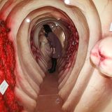 Darmkrebs-Vorsorge: Chemischer Nachweis von Blut im Stuhl  Anschaulicher geht es nicht: Das Bild zeigt das begehbare Modell des Darms samt der möglichen Krankheiten. Bei Frauen ist Darmkrebs die zweithäufigste Krebsart, bei Männern die dritthäufigste. Nicht rechtzeitig erkannt endet die Erkrankung in der Regel tödlich. Dabei erkranken Männer früher und häufiger an der der bösartigen Veränderung der Schleimhaut, meist im Dickdarm und im Enddarm. Ihr Risiko steigt zudem mit dem Alter. Bereits ab 50 wird die Vorsorge daher von den Kassen getragen. Bei Frauen hingegen tritt Darmkrebs später auf und steigt Studien zufolge noch einmal ab Mitte Siebzig an.   Ab 50 sollte man alles fünf Jahre eine Darmspiegelung einplanen. Die Methode ist sehr treffsicher und kann verhindern, dass Darmkrebs entsteht, da schon Vorstufen entfernt werden können. Sie liefert nur selten blinden Alarm, ihre Qualität wird in Deutschland überwacht, der Arzt muss die Untersuchung mindestens 200 Mal im Jahr durchführen.   Neben der aufwändigen Darmspiegelung lässt sich mögliches Tumorgeschehen auch über eine Stuhlprobe ermitteln. Beim Arzt bekommt man drei Testkärtchen oder Röhrchen für Stuhlproben. Wird im Labor der Blutfarbstoff Häm im Stuhl nachgewiesen, kann das auf einen Darmtumor hinweisen.  Allerdings kam In Studien heraus, dass der Test rund die Hälfte der Tumoren nicht erkennt. Obendrein schlägt er sehr oft Fehlalarm: Von zehn Untersuchungen mit einem Tumorbefund erweisen sich fünf bis acht später als falsch. Viele Faktoren wie der Verzehr von Blutwurst oder Brokkoli können den Test verfälschen. Trotzdem verhindert er unterm Strich Darmkrebstodesfälle, wenn auch minimal. Immunologische Stuhltests, die selbst bezahlt werden müssen, finden zwar mehr Tumoren, produzieren aber noch häufiger blinden Alarm.