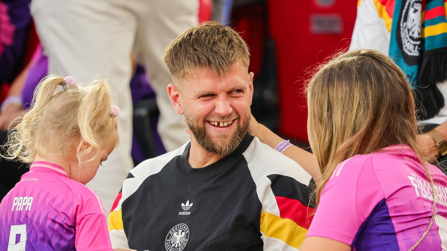 Niclas Füllkrug: Why the footballer has a gap in his teeth