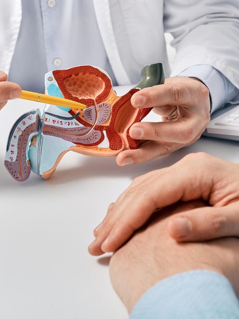 Symboldbild: Arzt zeigt auf medizinisches Modell einer Prostata