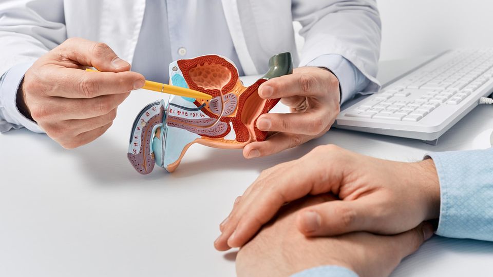 Symboldbild: Arzt zeigt auf medizinisches Modell einer Prostata Symboldbild: Arzt zeigt auf medizinisches Modell einer Prostata
