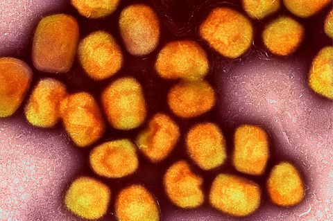Etwa 20 orange angefärbte Affenpocken-Viren unter dem Mikroskop