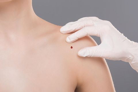 Hier finden Sie empfehlenswerte Kliniken in Ihrer Region im Bereich Schulterchirurgie 