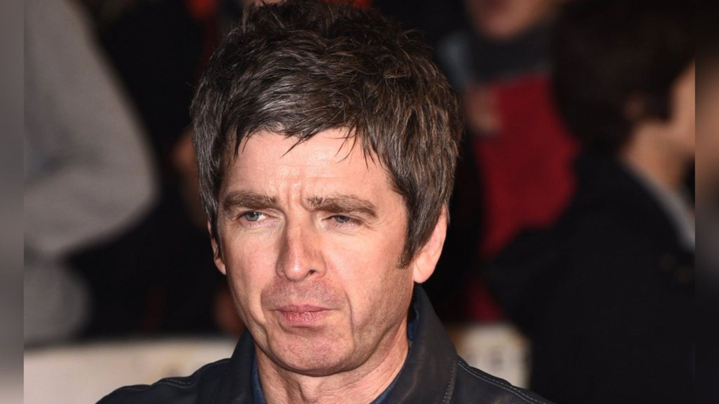 Noel Gallagher: Der Musiker lässt sich am Knie operieren
