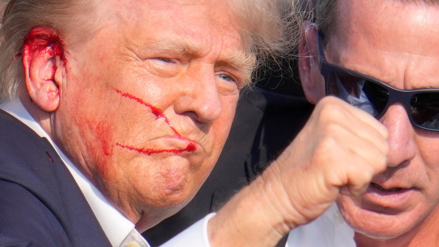 Donald Trump describes moments of the attack in interview