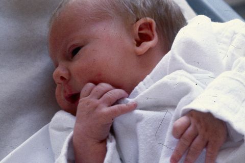 Ein Neugeborenes - das erste IVF Baby Louise Brown
