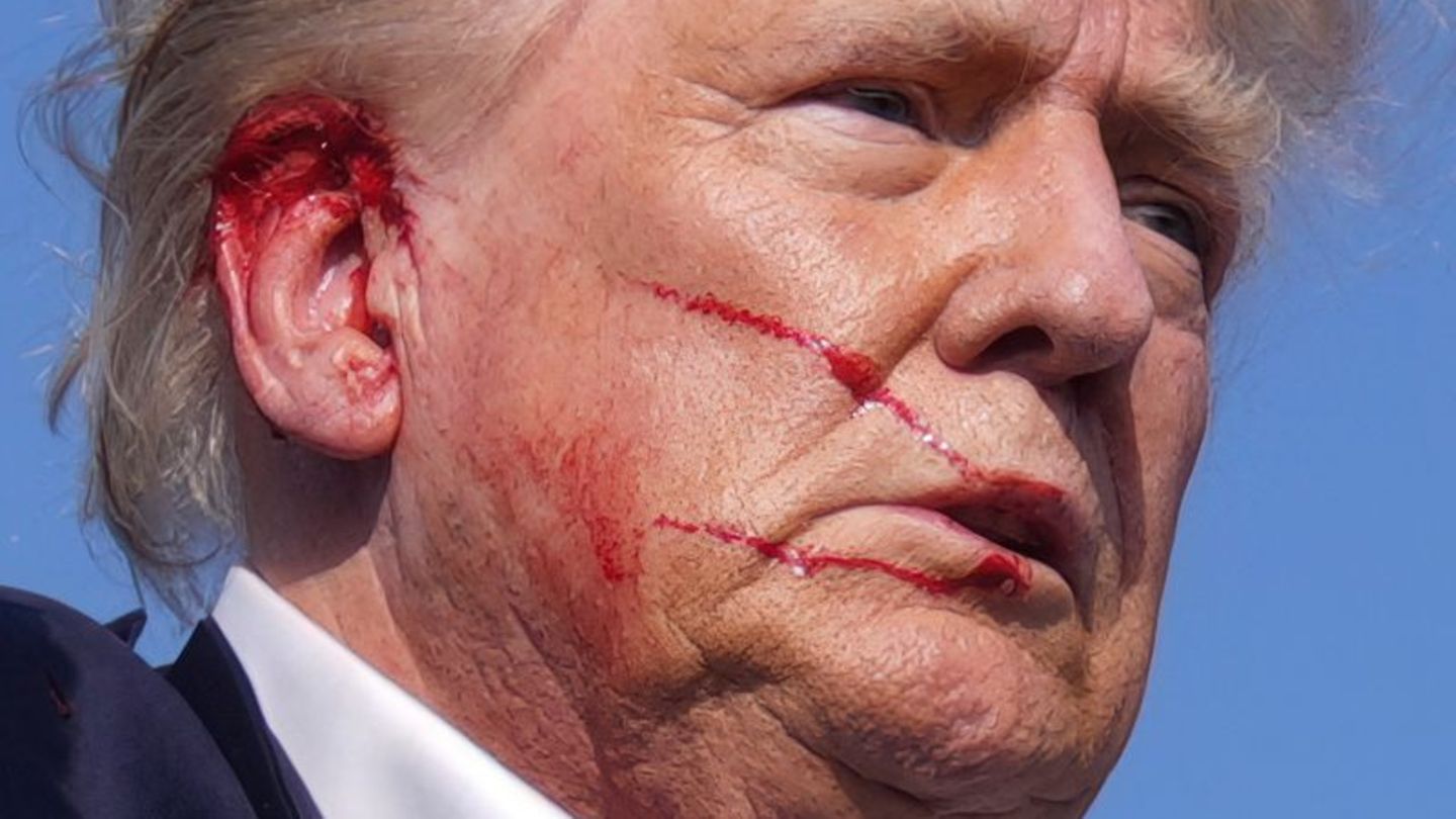 US-Wahlkampf: Trump-Arzt nach Attentat: Schusswunde am Ohr verheilt gut
