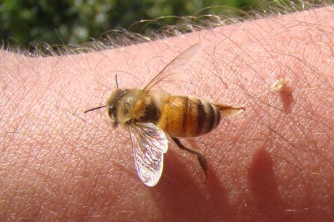 Bienenstich behandeln: Bienen hinterlassen den Stachel samt Giftblase in der Haut