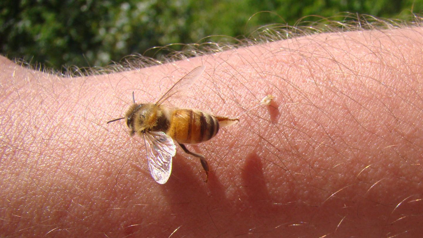 Erfahrungsbericht: Erste Hilfe nach dem Stich: Über das schmerzhafte Duell mit einer Honigbiene
