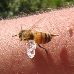 Bienenstich behandeln: Bienen hinterlassen den Stachel samt Giftblase in der Haut