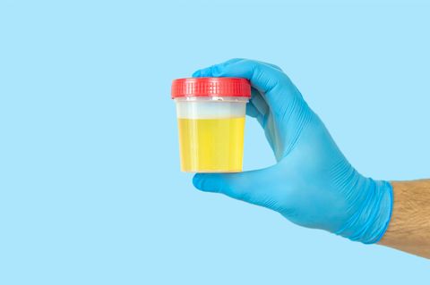 Thema Doping Urinprobe im Kunststoffbecher