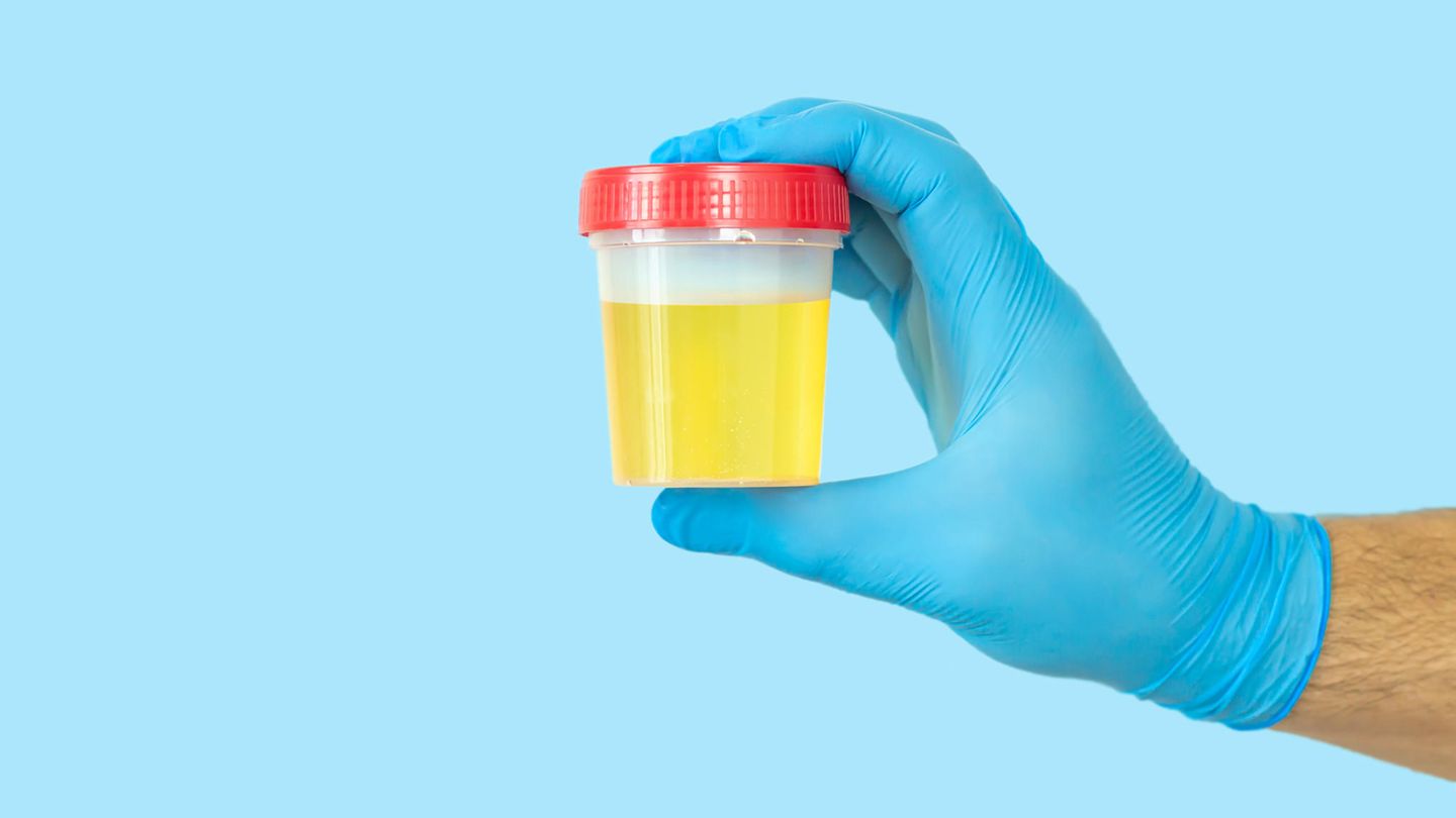 Thema Doping Urinprobe im Kunststoffbecher Thema Doping Urinprobe im Kunststoffbecher
