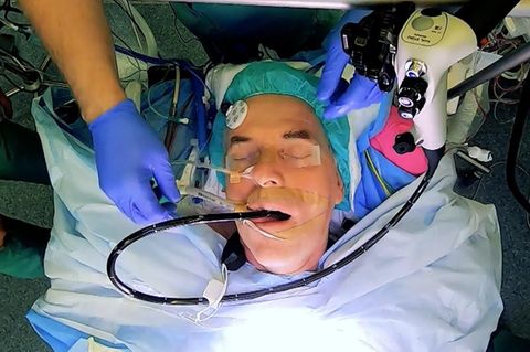 DIagnose Magenkrebs: Dieser Patient warnt: "Meine Geschichte kann Ihr Leben retten"