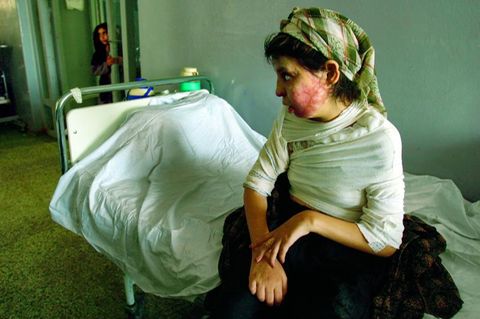Die 16-jährige Fariba in der Krankenstation für Schwerstverbrannte in der afghanischen Stadt Herat, 2004. Sie übergoss sich mit Petroleum und zündete sich an, um der Strafe ihres Vaters zu entgehen. Im Afghanistan der Taliban haben Frauen kaum Rechte