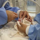 Nach der Geburt werden die beiden Panda-Babys vermessen und gewogen: Die Jungtiere wiegen 169 und 136 Gramm und sind etwa 14 cm lang.