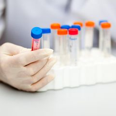 Das sind ausgezeichnete Ärzte in Ihrer Region im Bereich Lipidologie.