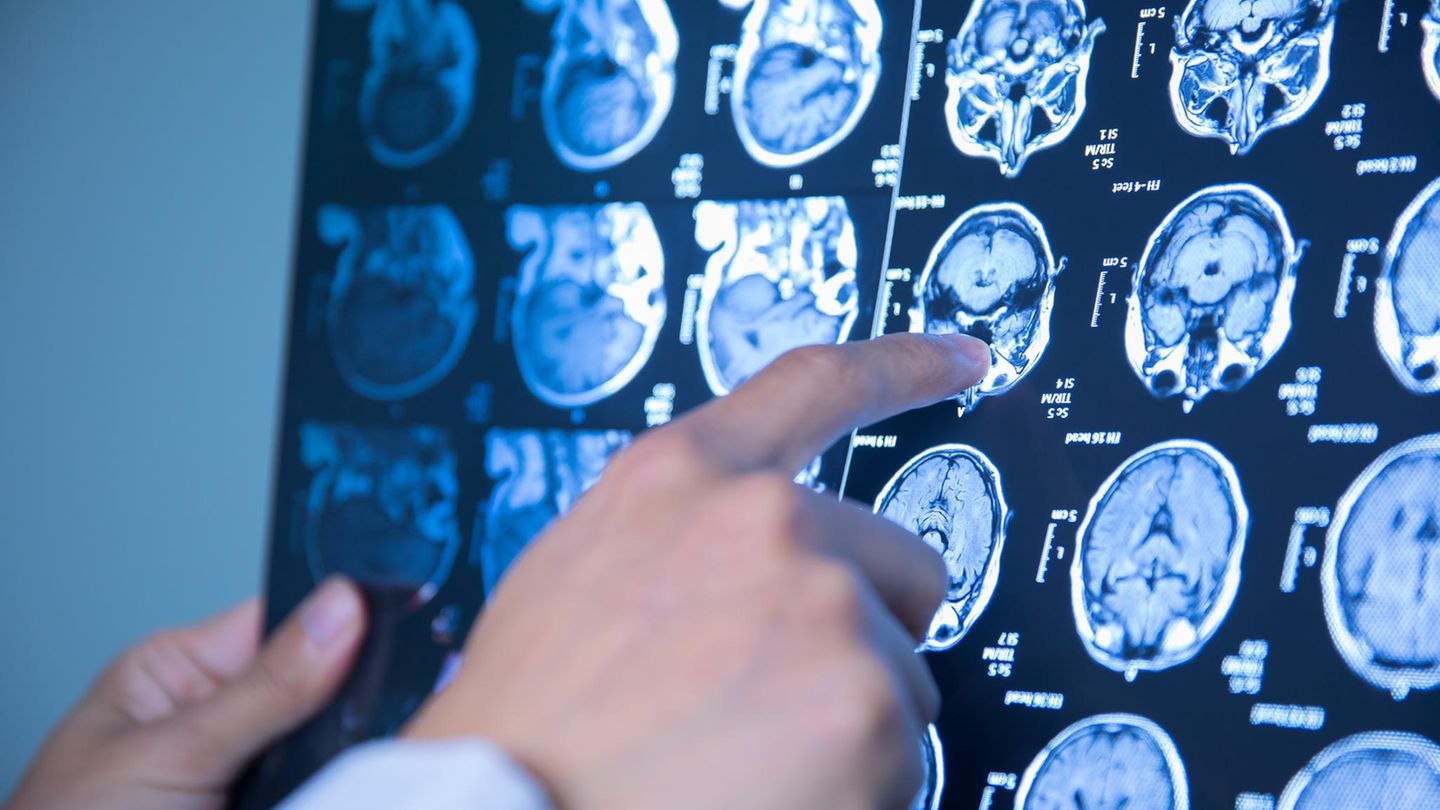 Das sind ausgezeichnete Ärzte in Ihrer Region im Bereich Neurologie. 