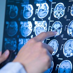 Das sind ausgezeichnete Ärzte in Ihrer Region im Bereich Neurologie. 