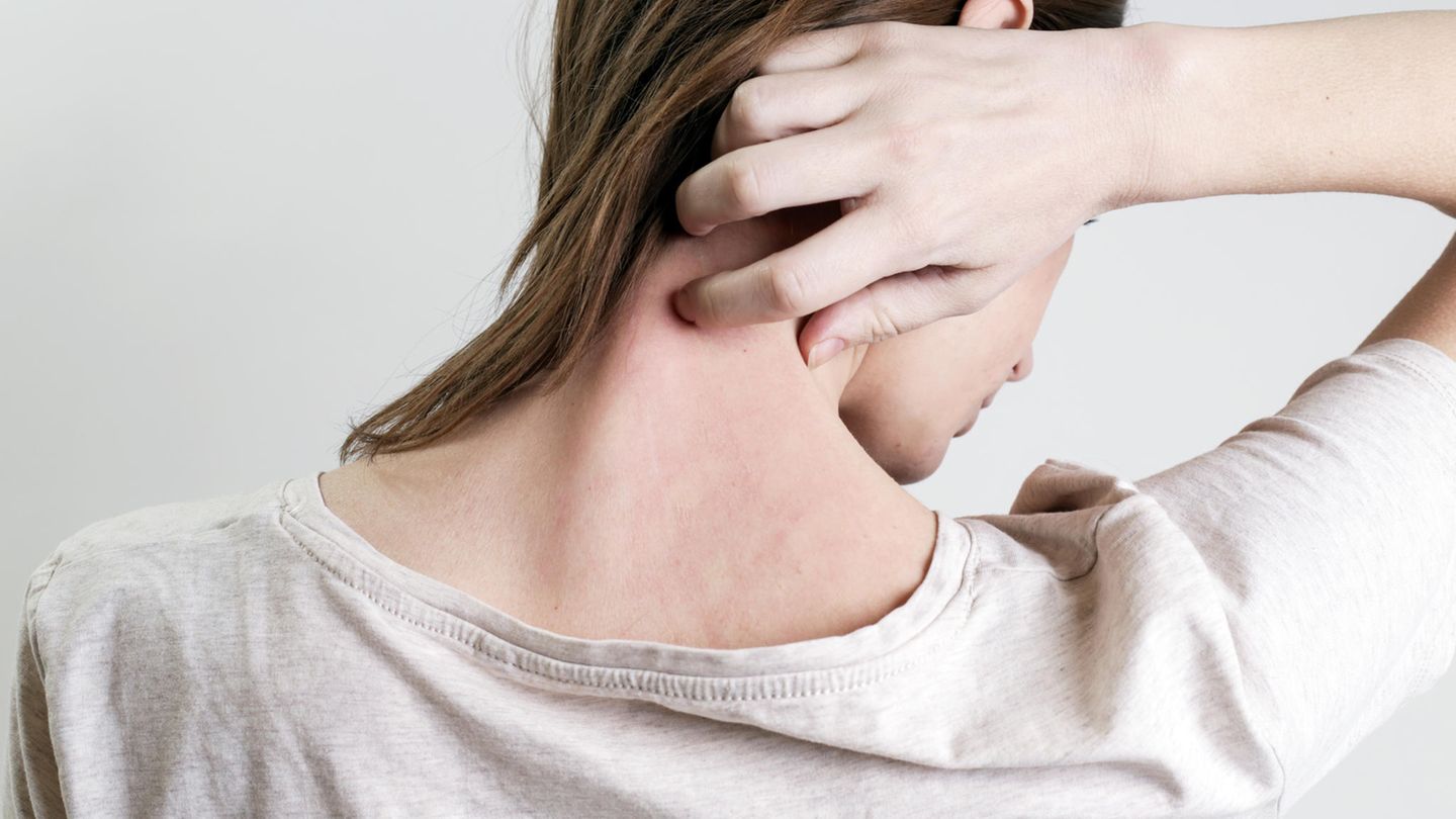 Das sind ausgezeichnete Ärzte in Ihrer Region im Bereich Psoriasis. 