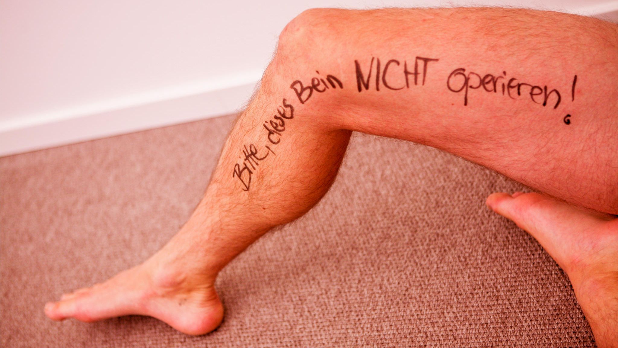 Kunstfehler: Männerbein mit Filzstift-Aufschrift: "Bitte dieses Bein nicht operieren"