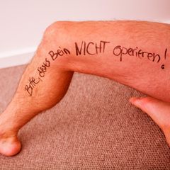 Kunstfehler: Männerbein mit Filzstift-Aufschrift: "Bitte dieses Bein nicht operieren"