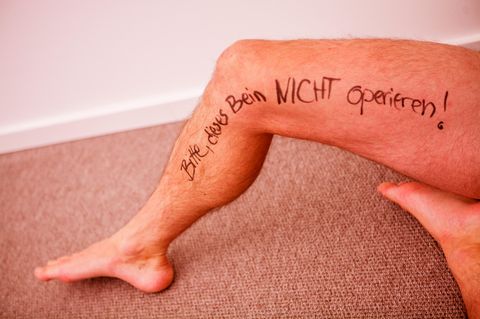 Kunstfehler: Männerbein mit Filzstift-Aufschrift: "Bitte dieses Bein nicht operieren"