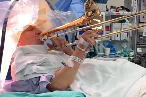 Bei Brian Rust wird ein Tremor diagnostiziert, seine Hände zittern unkontrolliert. Deshalb unterzieht er sich einer OP, bei der er ein ungewöhnliches Bild abgibt.